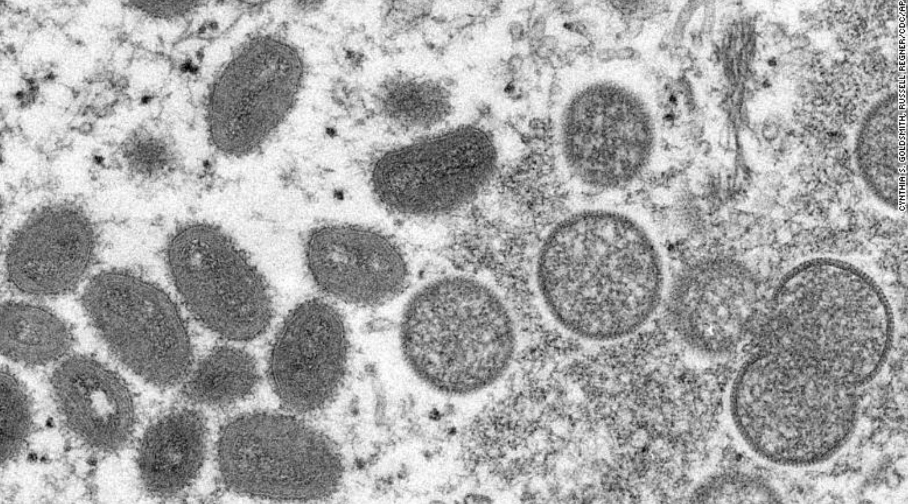 Обезьянья оспа распространялась «незаметно» в течение нескольких месяцев или лет