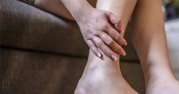 Набряки ніг можуть бути наслідком тромбозу і хвороби печінки